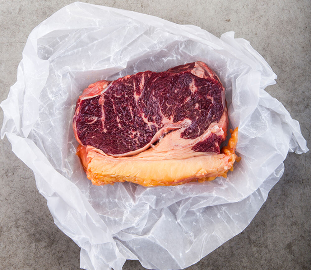 Ryggbiff med Kappa Premium Plus